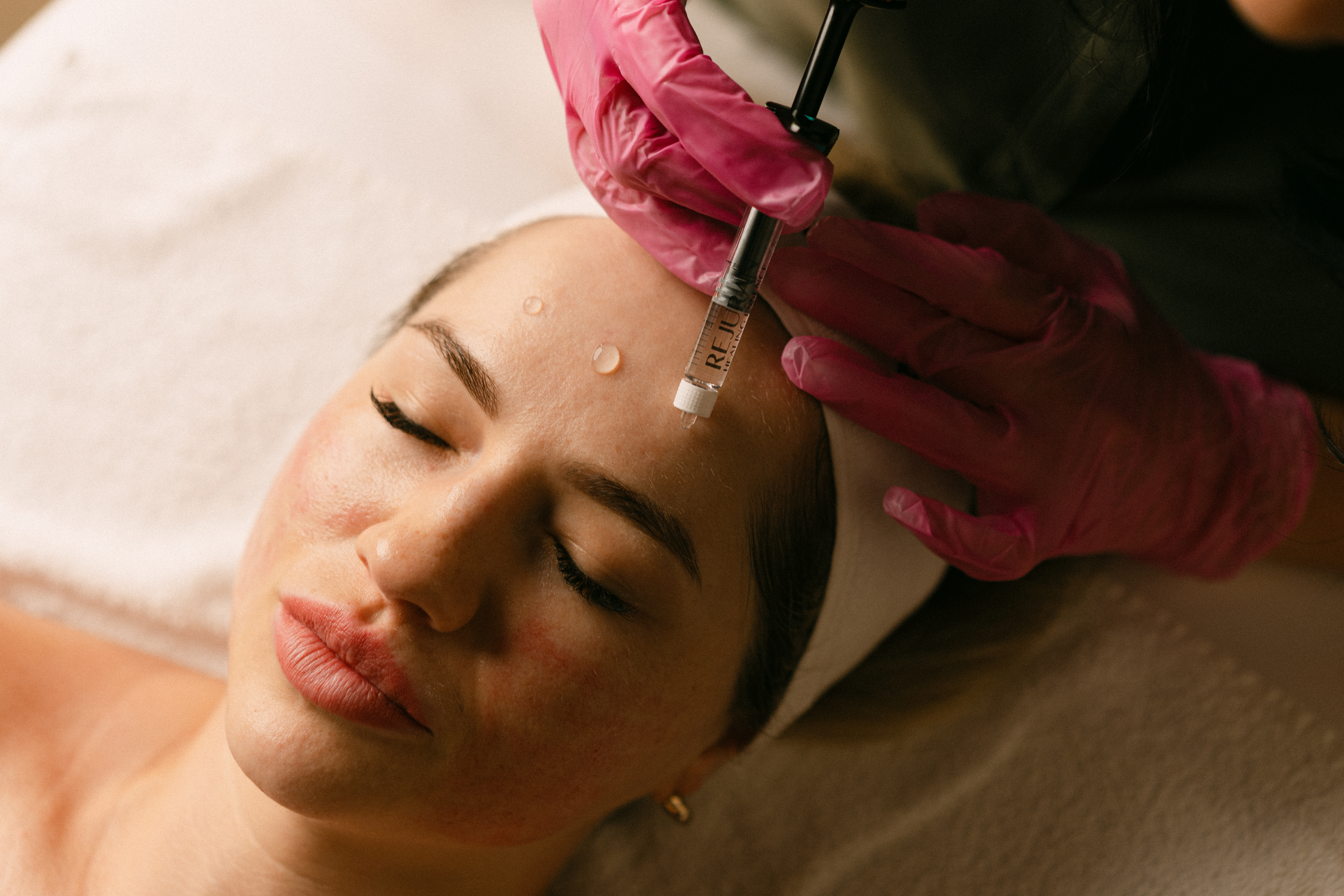 Microneedling + Exosomes
